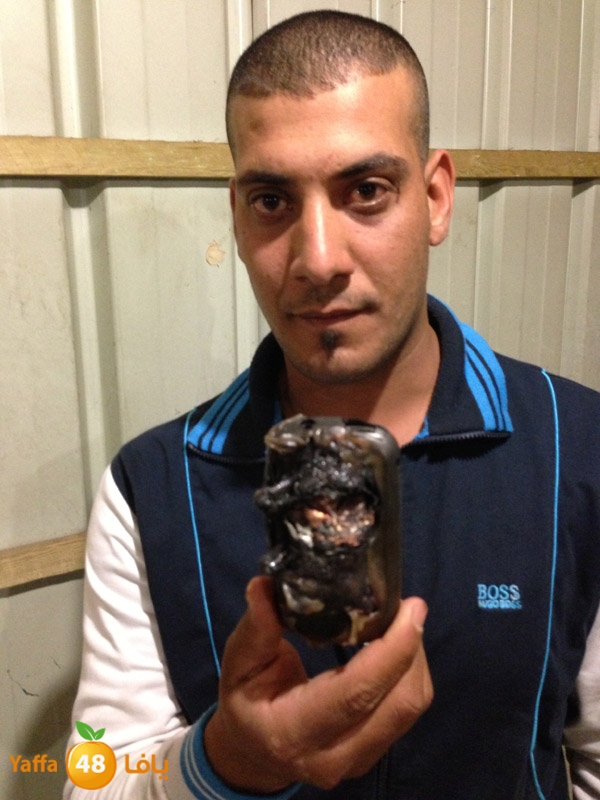 phoneludinjury (12).JPG